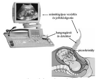 1. �bra. Az ultrahangos diagnosztika elve