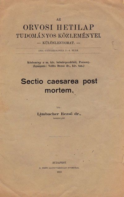 Sectio cesarea post mortem